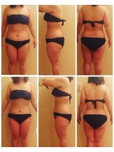 リラクゼーションアンドビューティーボヌール(BONHENR)/筋膜リリース