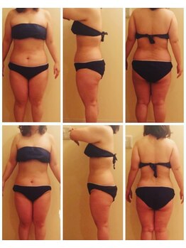 リラクゼーションアンドビューティーボヌール(BONHENR)/筋膜リリース