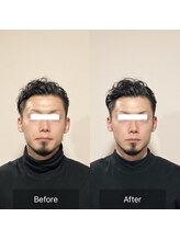 美骨整体シマサキ(SHIMASAKI)/◆美骨小顔