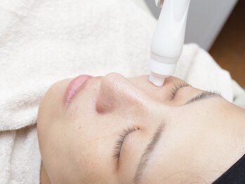 ホワイトニングビューティー 西宮店の写真/【西宮北口徒歩1分】気になる小鼻の毛穴悩みを集中改善★[小鼻のみ時短速攻ケア¥4500→¥3800]