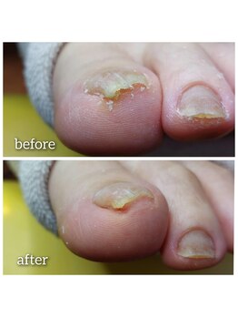 爪切り屋 足楽/