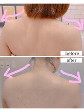 ミーティスジータ(mitis Gita)/リンパマッサージ