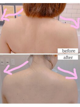 ミーティスジータ(mitis Gita)/リンパマッサージ