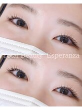 エスペランサ(Esperanza)/