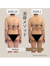 ソル(Sol)/美骨メソッド　before＆after