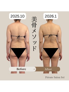 ソル(Sol)/美骨メソッド before&after