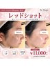【たるみ・二重あご】すっきり小顔◎レッドショット75分 ¥11,000