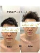メディカルサロンドオフ 堺東店(medical salon de off)/光造顔フェイシャル★ &nbsp;施術前後