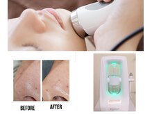 オスマンティエ(Osmantier)/美肌に導くマシン