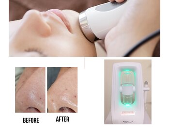 オスマンティエ(Osmantier)/美肌に導くマシン