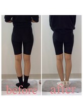 スタイルラボ高松/産後骨盤矯正の効果♪