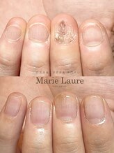 マリーロール 淀屋橋本店(Marie Laure)/自爪育成/深爪矯正/ネイルケア