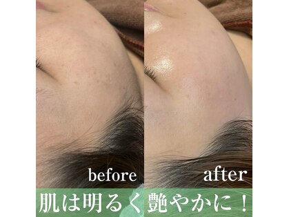 ブリリアント(brilliant)の写真