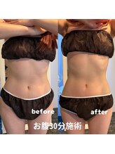 メトルミリ 新宿店(Metre milli)/ビフォーアフター