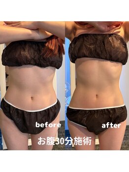 メトルミリ 新宿店(Metre milli)/ビフォーアフター