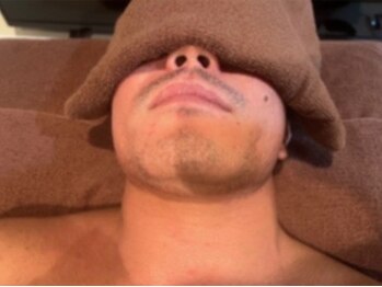 ヨハク(YOHAKU)/20代後半　男性　７回施術before