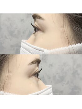 シャローム アローヴ(shalom alob)/【横から】マツパ