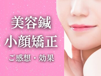 ワト(WATO)/■美容鍼&小顔 ご感想&効果