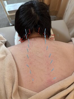 イズミ整骨院 大泉院/