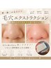 【毛穴の黒ずみ徹底除去】毛穴エクストラクション50分¥9,480→¥6,980