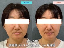 晴々の雰囲気（50代女性の変化！顔のむくみ、バランスが良くなっています！！）