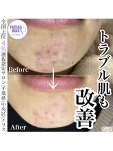 エリス(ELISSE)/フェイシャルワックス