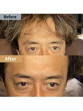 眉毛ハウス 吉祥寺店(眉毛HOUSE)/お客様の施術例(吉祥寺/東京)