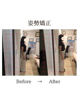 心斎橋長堀フェムテック整骨院/45姿勢矯正　骨格矯正と骨盤矯正