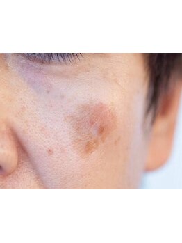 お肌をきれいにしたい