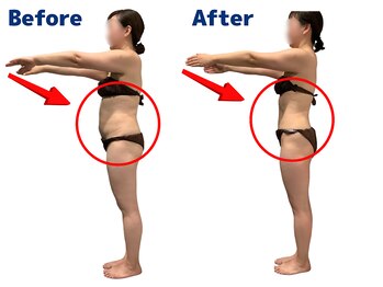 ワクワクボディクリニック 鶴ヶ峰店(WAKUWAKU BODY CLINIC)/ぽっこりお腹がスッキリ！