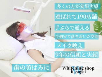ホワイトニングショップ 春日井店(whitening shop)