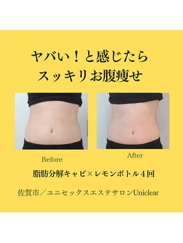 ユニクリア(Uni clear)/レモンボトル★入れ放題