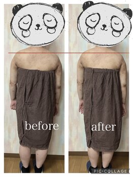 おはなれあ/背中クレイパック変化