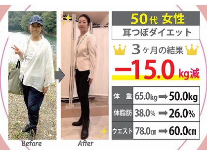 ボディスタイル(Body Style)の写真