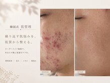 アネラボーテ(Anela Beaute)