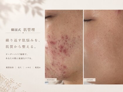 アネラボーテ(Anela Beaute)の写真