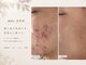 アネラボーテ(Anela Beaute)の写真