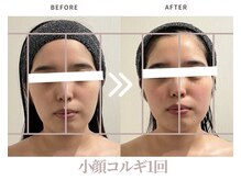 エステティックサロン ラ ベルタ(Esthetic Salon La Belta)/小顔コルギ