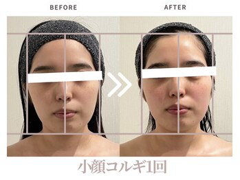 エステティックサロン ラ ベルタ(Esthetic Salon La Belta)/小顔コルギ