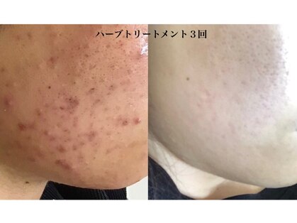 ティアス(t-us)の写真