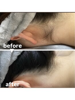 メゾン ド クロエ(Maison de Chloe)/ブライダルシェービング