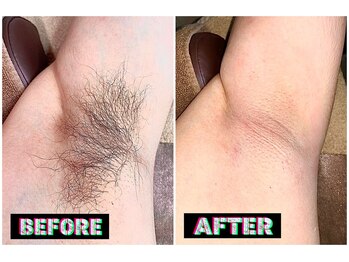 メンズスリーナインサロン(Men's ThreeNines Salon)/脇脱毛