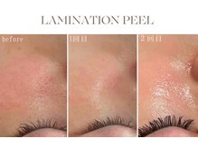 オリエンタルビューティー(ORIENTAL BEAUTY)/ラミネーションピール