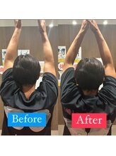 ナオル整体 宮崎院(NAORU整体)/50代男性施術事例【肩の制限】