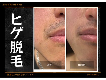 ダンニヒル(dannihil)の写真