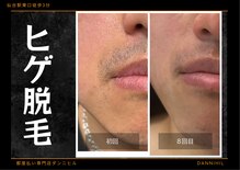 ダンニヒル(dannihil)