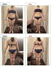 エステティック レイビス 銀座店(RAYVIS)/