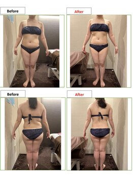 エステティック レイビス 銀座店(RAYVIS)/