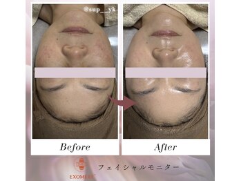 ノヴェル(Novelle)/リフトアップ＆ツヤ肌