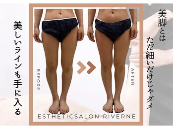 リヴェーヌ 富山店の写真/【お尻まで小さく♪】長年のガチむち太もも&ふくらはぎに徹底アプローチし脚の歪みを根本改善!丁寧な施術◎